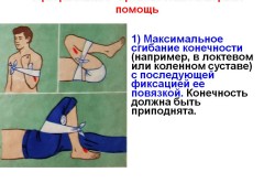Артериальное кровотечение и первая помощь Артериальное кровотечение и первая помощь