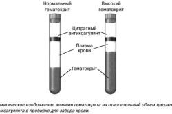 Нормальный и высокий гематокрит