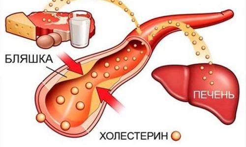 Как можно уменьшить холестерин в крови народными средствами?