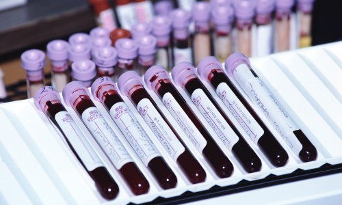 Лабораторный анализ крови на осмолярность