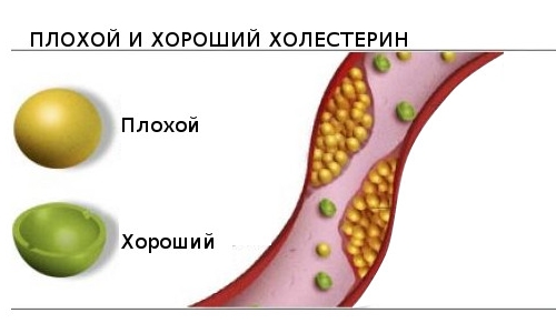 К чему ведет и как снизить повышенный холестерин в крови?