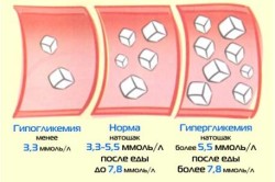 Норма и отклонения сахара в крови