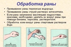 Первичная обработка раны