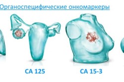 Виды онкомаркеров