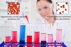Структура крови с анемией
