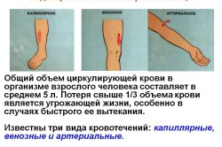 Виды кровотечений