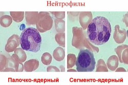 Виды нейтрофилов