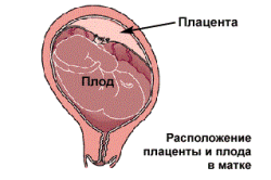 Расположение плаценты и плода в матке