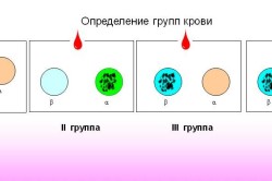 Определение группы крови