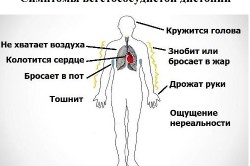 Вегетососудистая дистония как показание к проведению аутогемотерапии Вегетососудистая дистония как показание к проведению аутогемотерапии