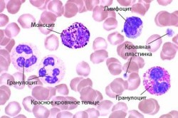 Моноциты в крови 